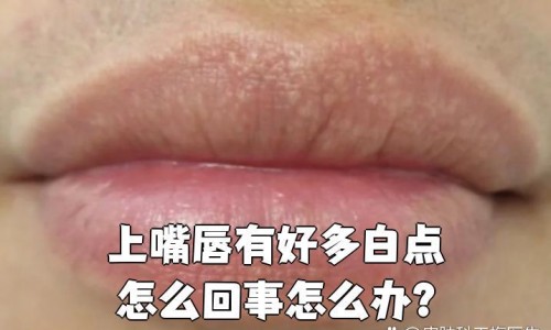月经期间催乳素会升高吗-月经期间催乳素270ulu网 - 为你提供月经期间催乳素高是什么原因、生理期催乳素800多正常吗
